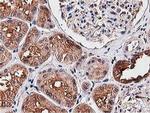 NUDT6 Antibody in Immunohistochemistry (Paraffin) (IHC (P))