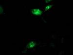 Aquaporin 1 Antibody in Immunocytochemistry (ICC/IF)