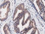 OGFOD1 Antibody in Immunohistochemistry (Paraffin) (IHC (P))