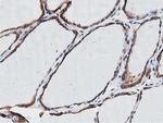 OGFOD1 Antibody in Immunohistochemistry (Paraffin) (IHC (P))