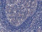 OGFOD1 Antibody in Immunohistochemistry (Paraffin) (IHC (P))