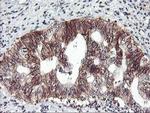 ZFP36 Antibody in Immunohistochemistry (Paraffin) (IHC (P))