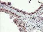 ZFP36 Antibody in Immunohistochemistry (Paraffin) (IHC (P))