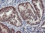 ZFP36 Antibody in Immunohistochemistry (Paraffin) (IHC (P))