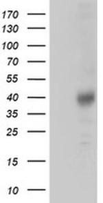 ZFP36 Antibody in Western Blot (WB)