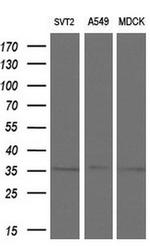 ZFP36 Antibody in Western Blot (WB)