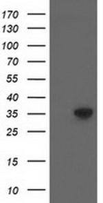 ACY3 Antibody in Western Blot (WB)