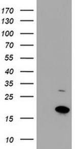 CHCHD5 Antibody in Western Blot (WB)