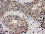 eIF4E2 Antibody in Immunohistochemistry (Paraffin) (IHC (P))