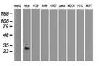 eIF4E2 Antibody in Western Blot (WB)