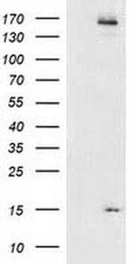 CHCHD5 Antibody in Western Blot (WB)