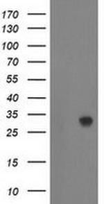 ZFAND2B Antibody in Western Blot (WB)