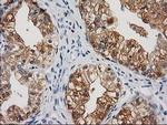 CTH Antibody in Immunohistochemistry (Paraffin) (IHC (P))