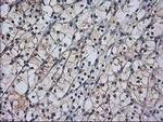 RASSF1 Antibody in Immunohistochemistry (Paraffin) (IHC (P))