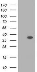 RASSF1 Antibody in Western Blot (WB)