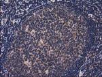 ACOT12 Antibody in Immunohistochemistry (Paraffin) (IHC (P))