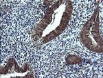 NDUFB9 Antibody in Immunohistochemistry (Paraffin) (IHC (P))