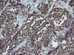 NDUFB9 Antibody in Immunohistochemistry (Paraffin) (IHC (P))