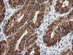 15-PGDH Antibody in Immunohistochemistry (Paraffin) (IHC (P))