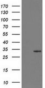 15-PGDH Antibody in Western Blot (WB)