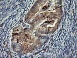 VASP Antibody in Immunohistochemistry (Paraffin) (IHC (P))