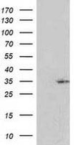 NORE1 Antibody in Western Blot (WB)