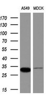 NORE1 Antibody in Western Blot (WB)