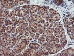 HDHD1 Antibody in Immunohistochemistry (Paraffin) (IHC (P))