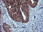 HDHD1 Antibody in Immunohistochemistry (Paraffin) (IHC (P))