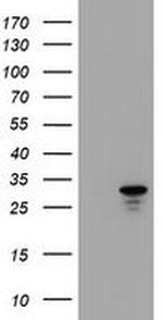 HDHD1 Antibody in Western Blot (WB)