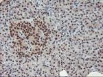 POLR2E Antibody in Immunohistochemistry (Paraffin) (IHC (P))