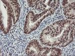 POLR2E Antibody in Immunohistochemistry (Paraffin) (IHC (P))