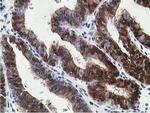 15-PGDH Antibody in Immunohistochemistry (Paraffin) (IHC (P))