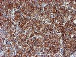 NDUFB9 Antibody in Immunohistochemistry (Paraffin) (IHC (P))