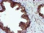 NDUFB9 Antibody in Immunohistochemistry (Paraffin) (IHC (P))