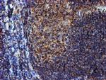 NDUFB9 Antibody in Immunohistochemistry (Paraffin) (IHC (P))