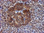 NDUFB9 Antibody in Immunohistochemistry (Paraffin) (IHC (P))