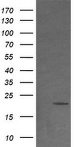 NDUFB9 Antibody in Western Blot (WB)