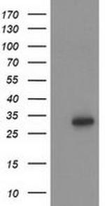 HOXC11 Antibody in Western Blot (WB)