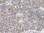 LACTB2 Antibody in Immunohistochemistry (Paraffin) (IHC (P))