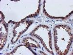 LACTB2 Antibody in Immunohistochemistry (Paraffin) (IHC (P))