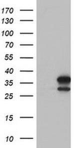 LACTB2 Antibody in Western Blot (WB)