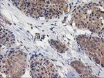 GBA3 Antibody in Immunohistochemistry (Paraffin) (IHC (P))