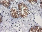 GBA3 Antibody in Immunohistochemistry (Paraffin) (IHC (P))