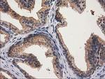 GBA3 Antibody in Immunohistochemistry (Paraffin) (IHC (P))