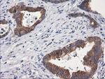 GBA3 Antibody in Immunohistochemistry (Paraffin) (IHC (P))