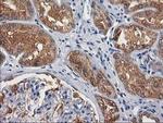 GBA3 Antibody in Immunohistochemistry (Paraffin) (IHC (P))