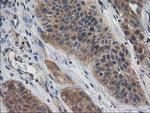 GBA3 Antibody in Immunohistochemistry (Paraffin) (IHC (P))