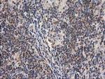 GBA3 Antibody in Immunohistochemistry (Paraffin) (IHC (P))