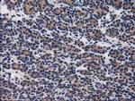 GBA3 Antibody in Immunohistochemistry (Paraffin) (IHC (P))